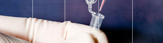 View a sample DNA Test result by easyDNA 
